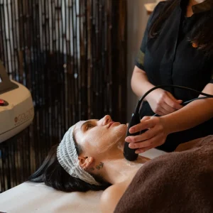 radiofrequenza golden