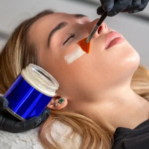 PEELING CHIMICO VISO